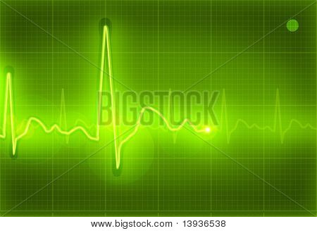 Электрокардиограмма, eps10