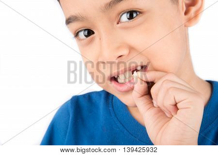 Little boy showing baby teeth toothless close up waiting for new teeth