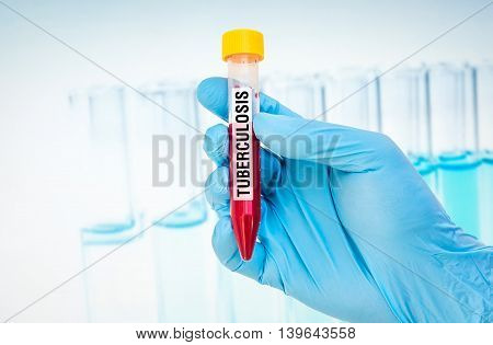 Test-tube With Blood Sample For Tuberculosis Test