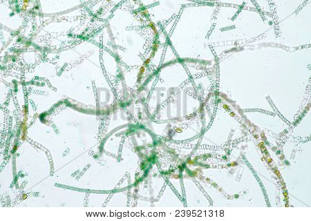 Filamentous Algae Are Single Algae Cells That Form Long Visible Chains, Threads, Or Filaments.