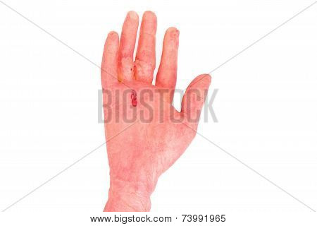 the hand