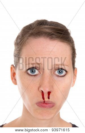 Young Pretty Woman With Epistaxis