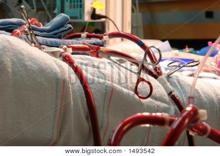 Circuito de ECMO