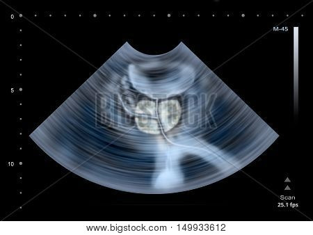 Ultrasound scan of human Prostate. Illustration,3D render
