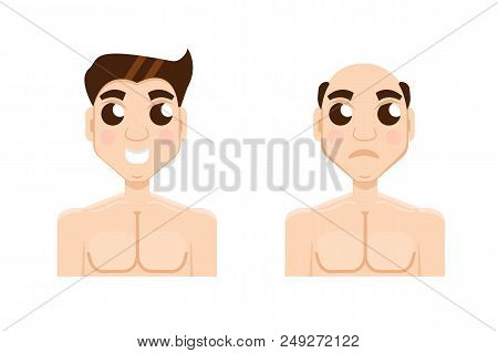 Hair Stages Loss. Types Of Baldness On Male Head Vector.