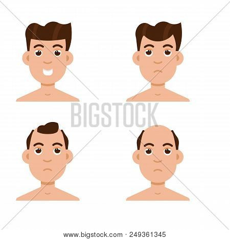 Hair Stages Loss. Types Of Baldness On Male Head Vector.