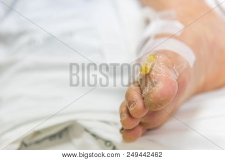 Patient With Saline Intravenous In The Hospital