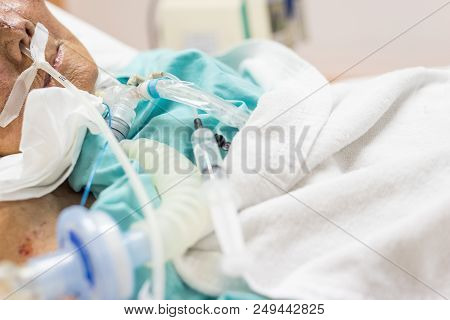 Patient Do Tracheostomy And Ventilator In Hospital