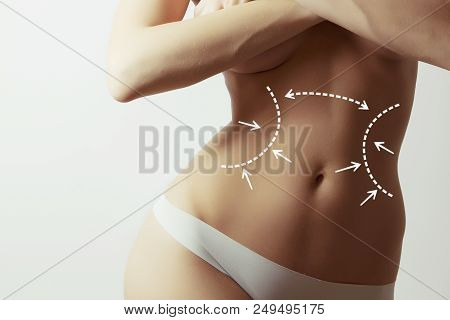 Lymph Drainage For Woman Body, Concept Photo With Graphic Marks