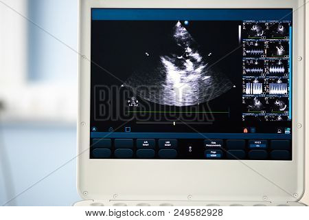 The Screen Of The Ultrasound Device With The Image Of The Heart Cut, On Which The Outflow Tract Of T