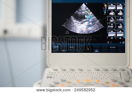 Screen Of An Ultrasound Device With A Heart Scan. Using The Doppler Method, The Right Ventricular Ou