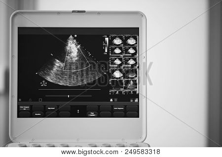 On The Screen Of The Ultrasound Device, A Heart Scan In A Four-chamber Position With A Demonstration