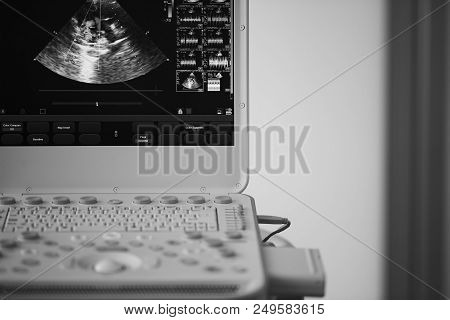 On The Screen Of A Modern Ultrasound Scanner, An Image Of The Heart Cavities With Red And Blue Strea