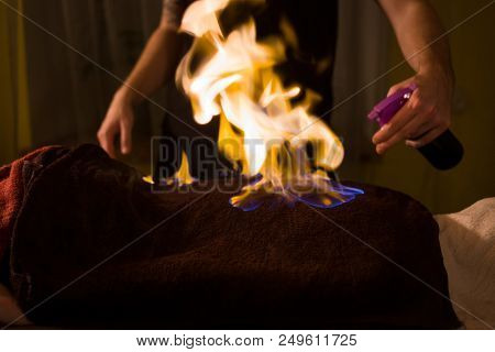 Chinese Fire Massage - Huo Liao Therapy. Traditional Chinese Medicine, Fire Treatment And Bodycare C
