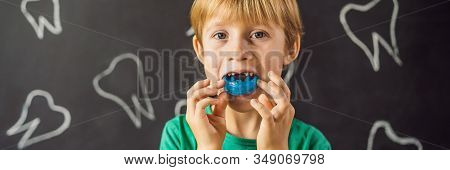 Banner, Long Format Six-year Old Boy Shows Myofunctional Trainer. Helps Equalize The Growing Teeth A