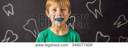 Banner, Long Format Six-year Old Boy Shows Myofunctional Trainer. Helps Equalize The Growing Teeth A