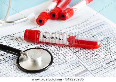 Red Blood Vial With Blood Sample For Hepatitis B Test Checking.