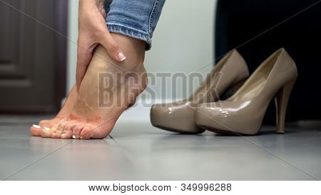 Female Touching Painful Legs By High Heel Shoes, Inflammation Problem, Callus