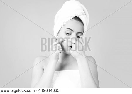 Woman Squeezing Pimples On Her Face. Acne Blemish Spots Skin On Young Woman. Spot Scar Acne, Freckle