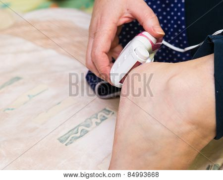 Dry Skin On Foot Removing