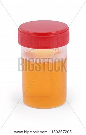 Sterile Medical container for urine with biomaterial. Clipping path inside.