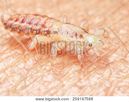 3d rendered medically accurate illustration of a head louse on human skin