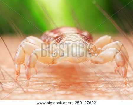 3d rendered medically accurate illustration of a head louse on human skin