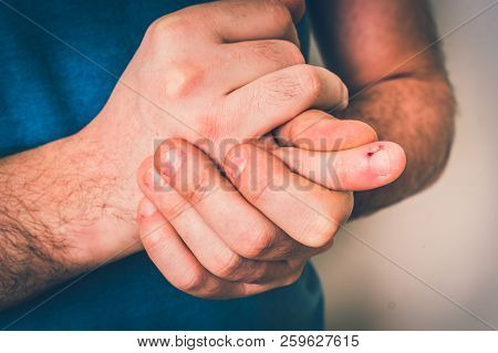 Man With Finger Pain Is Holding His Aching Finger - Body Pain Concept - Retro Style