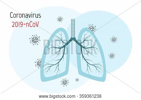 Virus Cells In Lung. Infected Lungs. Coronavirus, Covid-19. 2019-ncov. Lung Disease, Pneumonia, Asth