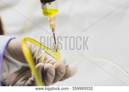 Anesthesiologist Doctors Hand Inject The Medication Through A Syringe Into Extension Tube Of Normal 