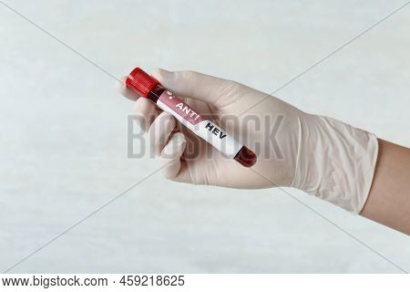Scientist Holding Tube With Blood Sample And Label Anti Hev On Light Background, Closeup