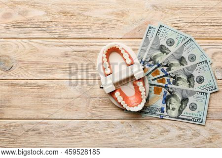 Closeup Model Of A Human Jaw With White Teeth And Dollar Bill. Dentistry Conceptual Photo. Prostheti