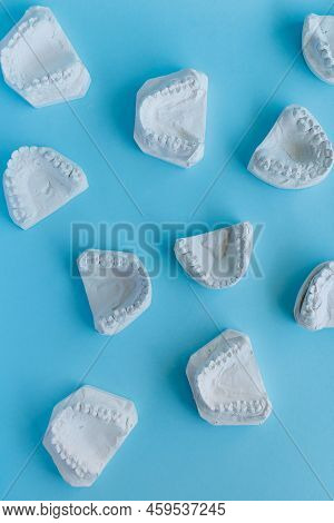 Lots Of Dental Plaster Cast Of Human Theeth