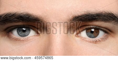 Man With Beautiful Eyes Of Different Colors, Closeup. Heterochromia Iridis