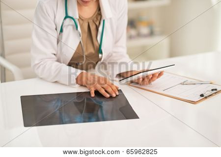 Closeup On Medical Doctor Woman With Fluorography Using Tablet P