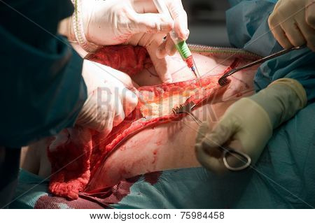 Operation In Hospital