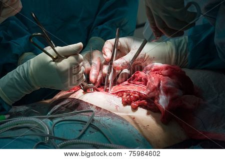 Surgeons Operating In Hospital