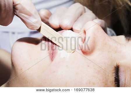 Depilation with hot wax mustache in the beauty salon. Young woman receiving facial epilation close up. Cosmetologist removes hair on face. Beauty salon mustache depilation