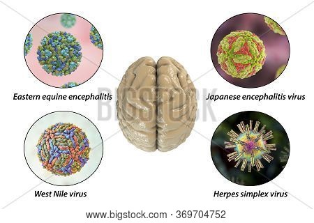 Brain Infections, Microorganisms That Cause Encephalitis And Meningitis