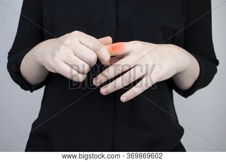 Woman Suffers From Pain In Fingers. Arthritis Or Arthrosis, Cartilage Wear, Rheumatism Of The Joints