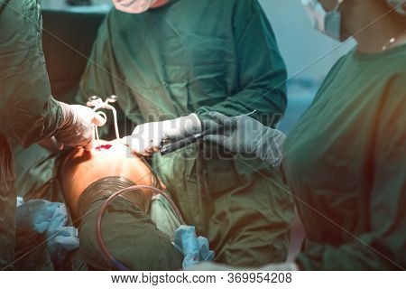 Real Hip Replacement Surgery In Progress, Open Cavity With Scalpel And Soft-tissue Retractors. Old A