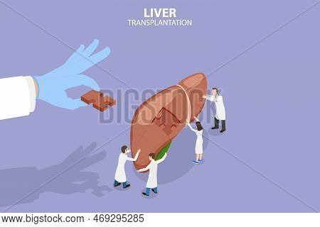 3d Isometric Flat Vector Conceptual Illustration Of Liver Transplantation, Donation Organs