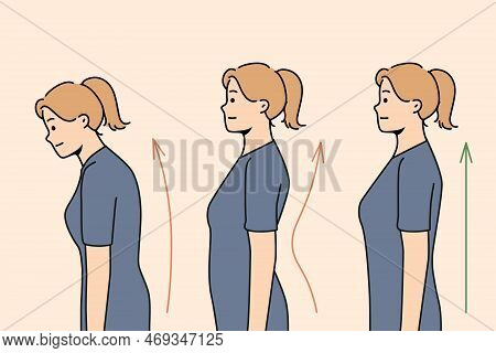 Set Of Young Woman Posture Correction. Collection Of Female With And Without Back Problems. Healthca