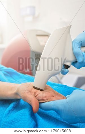 Procedure for palm against hyperhidrosis