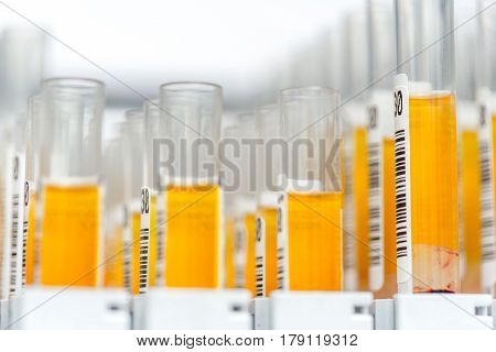 Laboratory glass test tubes filled with orange liquid for an experiment in a science research lab. Analyzes