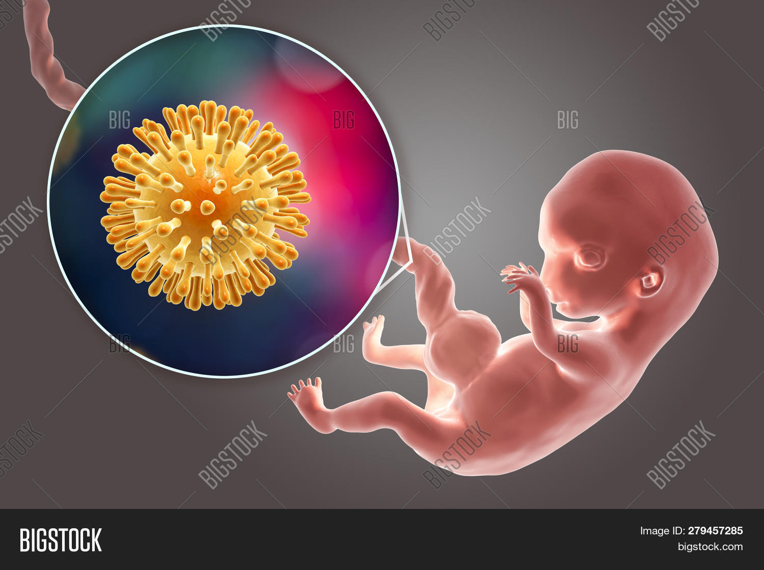 Transplacental Image & Photo (Free Trial) Bigstock