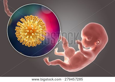 Transplacental Transmission Of Human Immunodeficiency Virus Hiv, Aids Virus To Human Embryo, 3d Illu