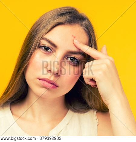 Portrait Of Sad Teen Gerl Touching Her Face And Looking For Acne On Yellow Background