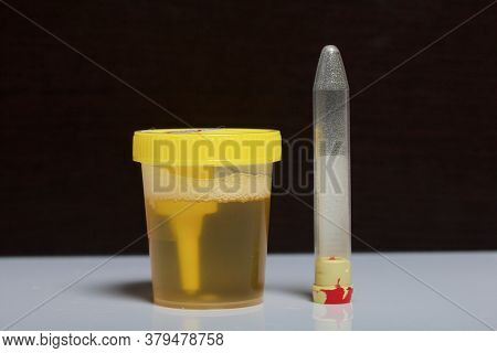 Urine In A Container For Analysis. Disposable Medical Polymer Sterile Container With A Built-in Hold