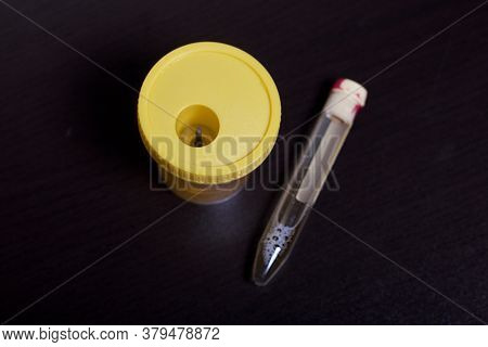 Urine In Test Container And Vacuum Tube. Disposable Medical Polymeric Sterile Container With A Built